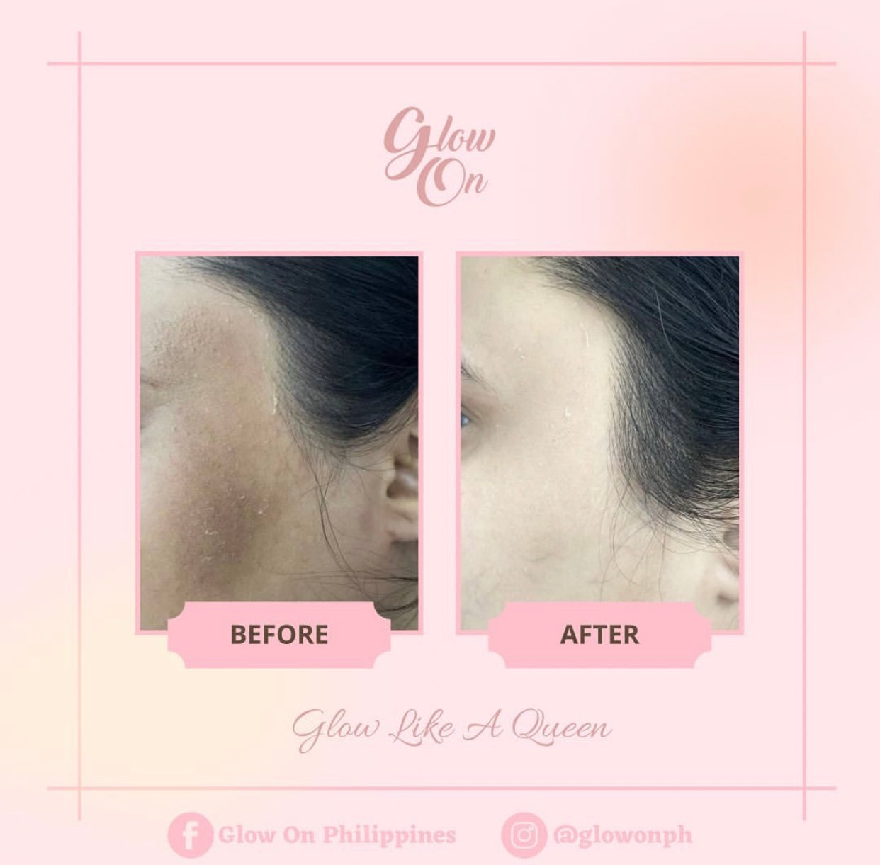 GlutaMilk Ultimate Whitening Bar